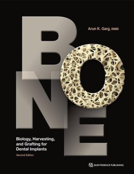 Bone: Biology, Harvesting, and Grafting for Dental Implants 2nd Edition