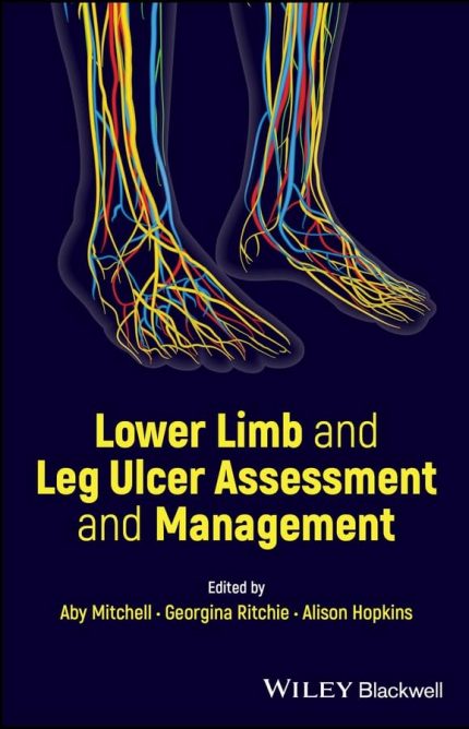 Lower Limb and Leg Ulcer Assessment and Management 1st Edition