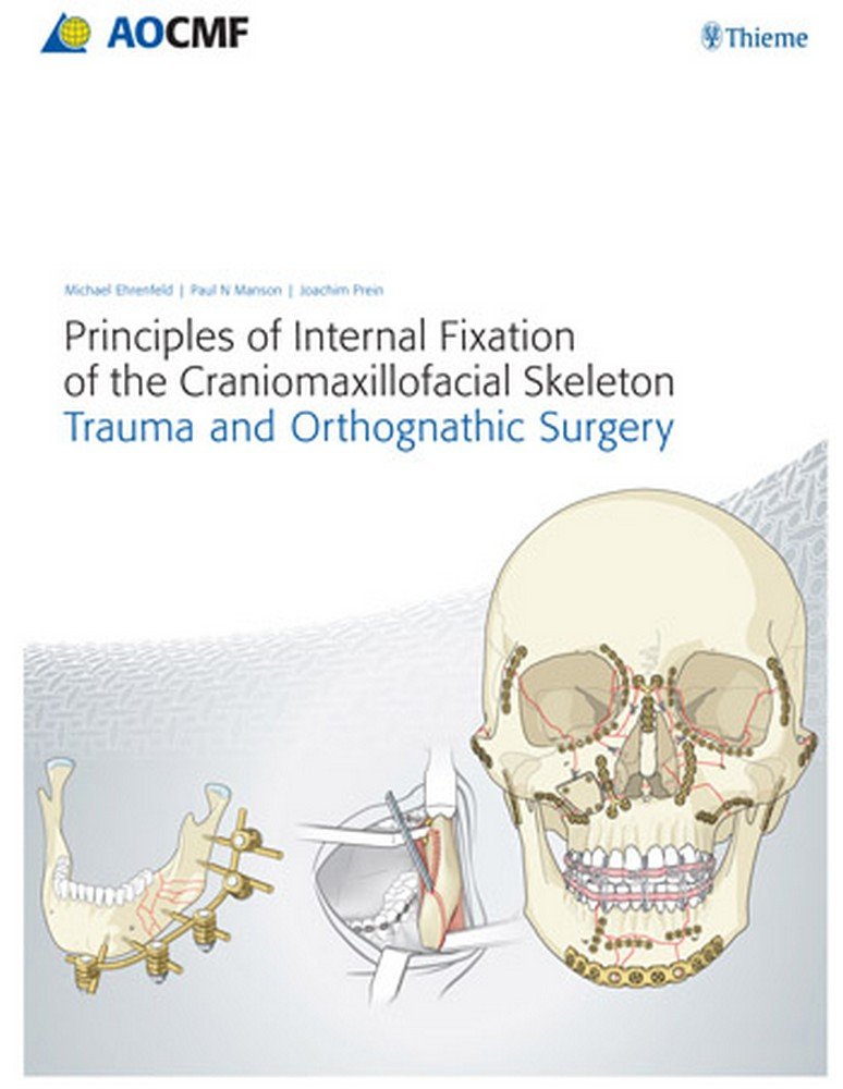 Principles of Internal Fixation of the Craniomaxillofacial Skeleton: Trauma and Orthognathic Surgery