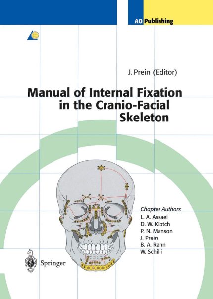 Manual of Internal Fixation in the Cranio-Facial Skeleton: Techniques Recommended by the AO/ASIF Maxillofacial Group