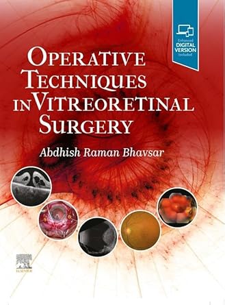 Operative Techniques in Vitreoretinal Surgery