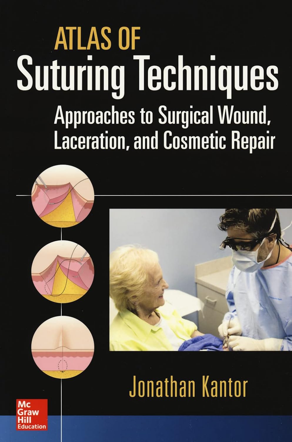 Atlas of Suturing Techniques: Approaches to Surgical Wound, Laceration, and Cosmetic Repair 1st Edition (Only PDF)