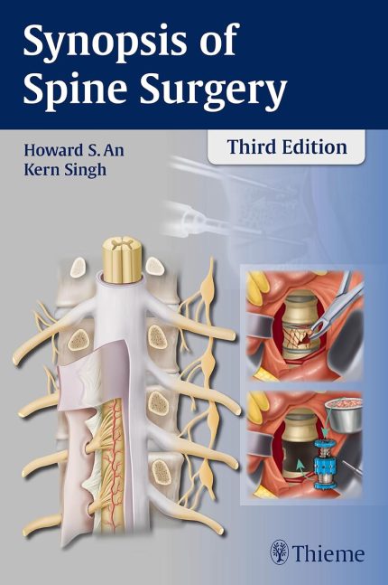 Synopsis of Spine Surgery