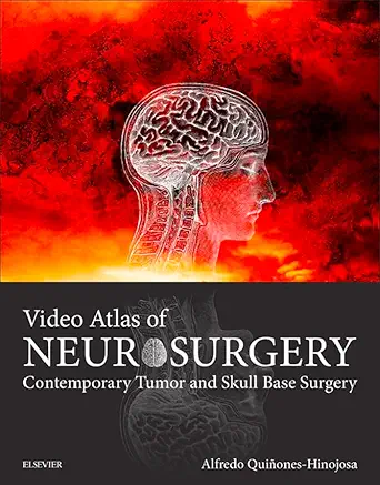 Video Atlas of Neurosurgery E-Book (PDF only)