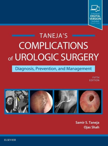 Complications of Urologic Surgery: Prevention and Management - Only PDF