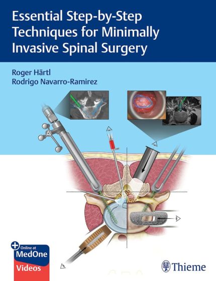 Essential Step-by-Step Techniques for Minimally Invasive Spinal Surgery (videos)