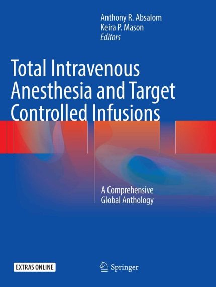 Total Intravenous Anesthesia and Target Controlled Infusions: A Comprehensive Global Anthology Softcover reprint of the original.