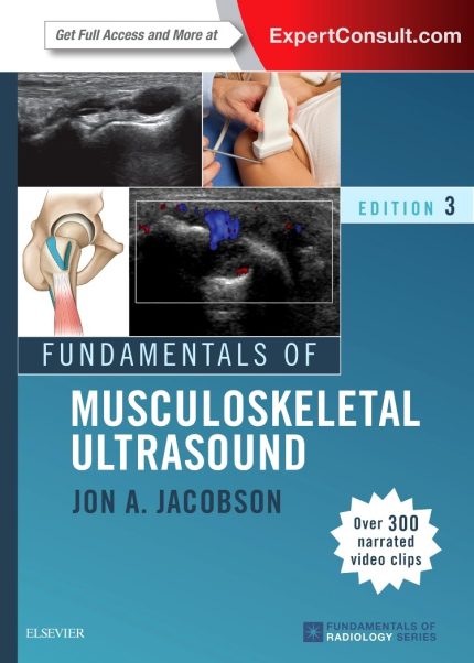 Fundamentals of Musculoskeletal Ultrasound (Fundamentals of Radiology) - PDF only