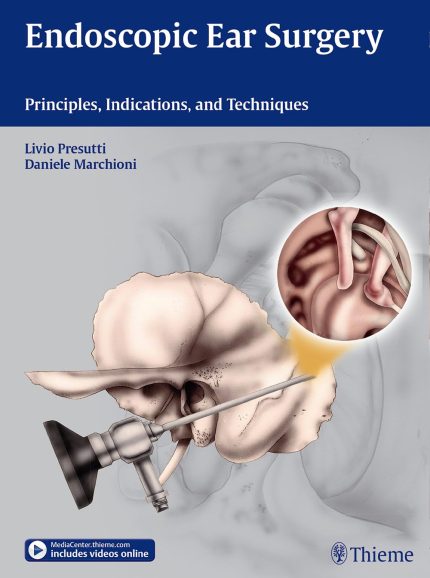 Endoscopic Ear Surgery: Principles, Indications, and Techniques (without Videos)