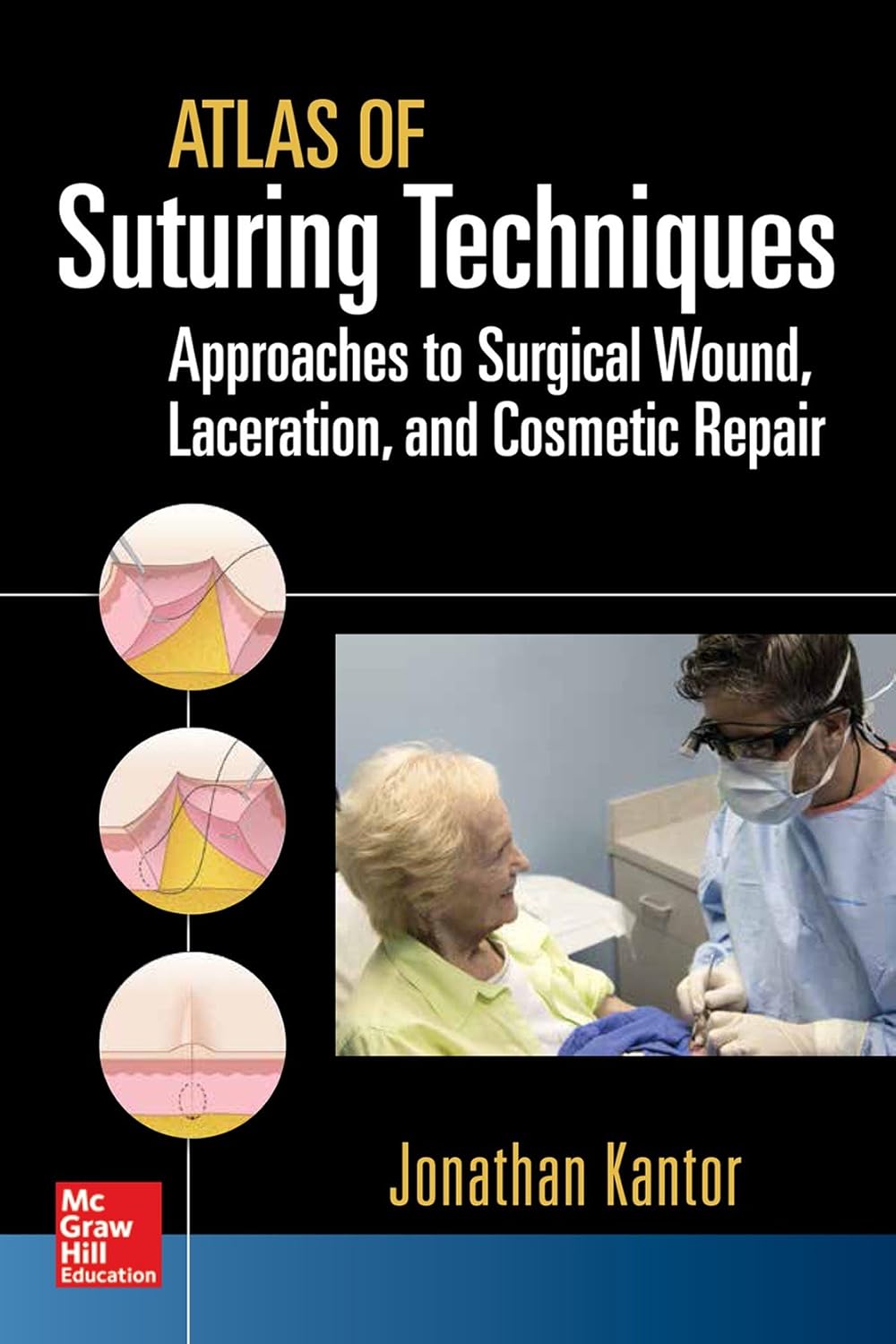Atlas of Suturing Techniques: Approaches to Surgical Wound, Laceration, and Cosmetic Repair