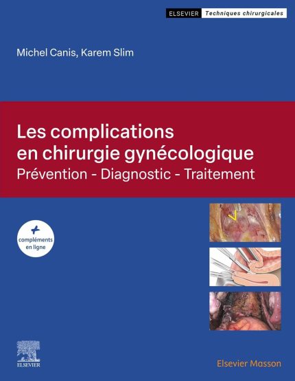 Les complications en chirurgie gynécologique: Prévention - Diagnostic - Traitement (French Edition)