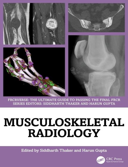 Musculoskeletal Radiology: An Ultimate Guide to Passing the Final FRCR (FRCRverse)