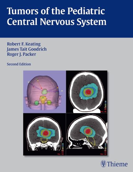 Tumors of the Pediatric Central Nervous System (ep)