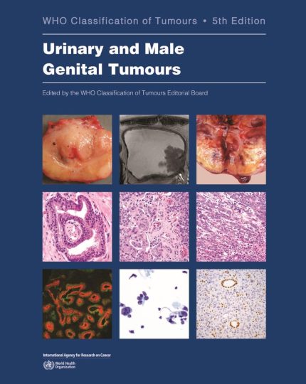 Urinary and Male Genital Tumours (WHO Classification of Tumours)