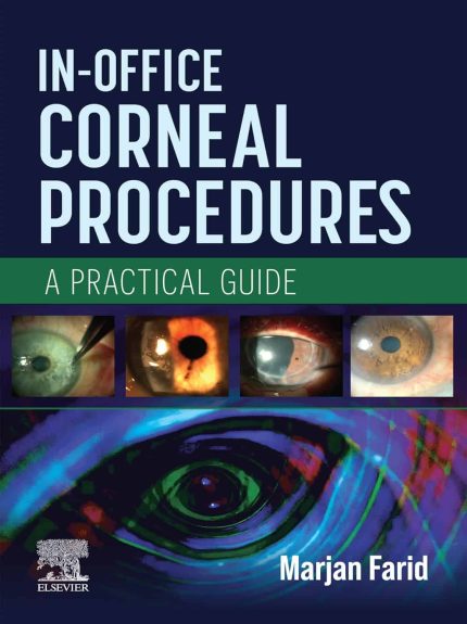 In-Office Corneal Procedures - E-BOOK: A Practical Guide