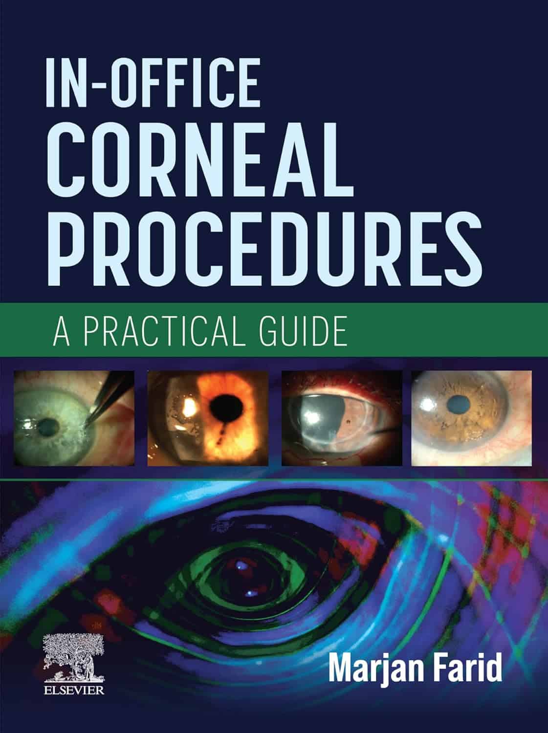 In-Office Corneal Procedures - E-BOOK: A Practical Guide