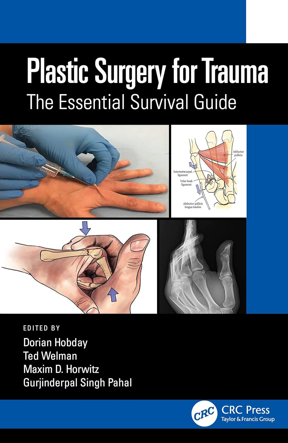 Plastic Surgery for Trauma: The Essential Survival Guide 1st Edition