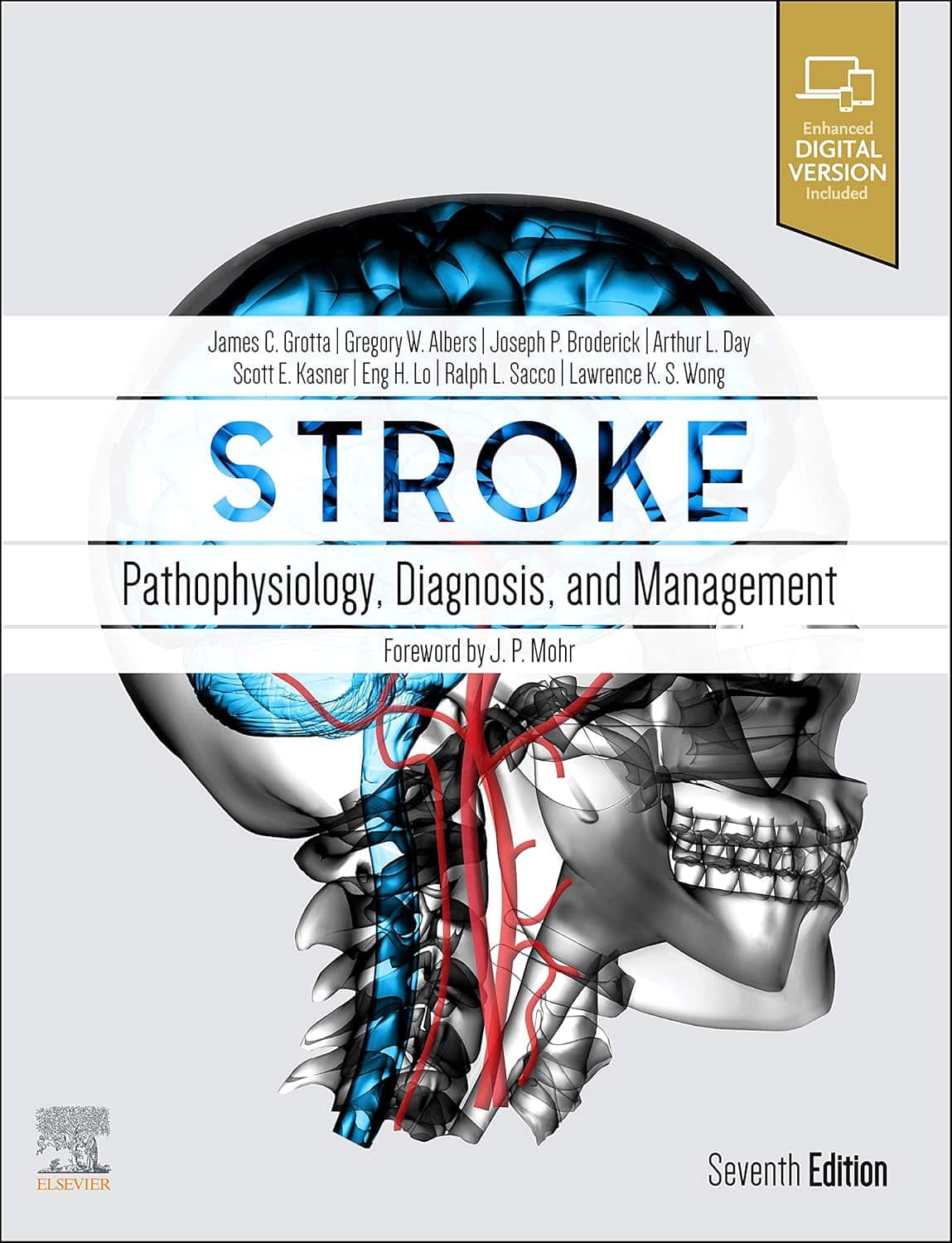 Stroke: Pathophysiology, Diagnosis, and Management
