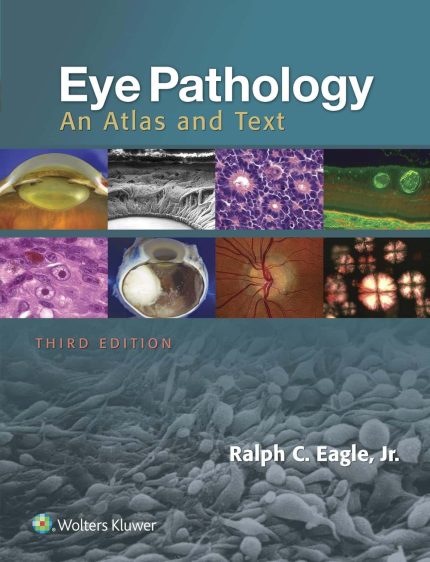 Eye Pathology: An Atlas and Text