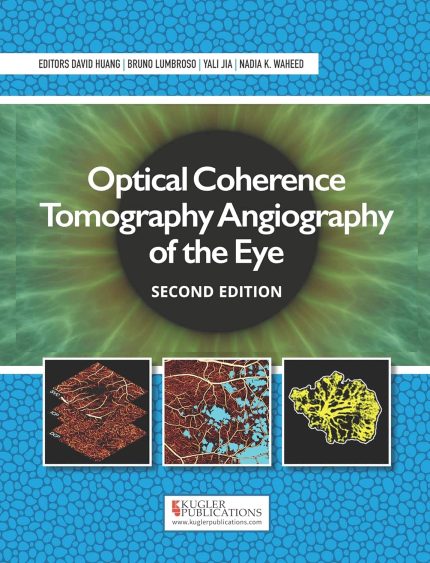 Optical Coherence Tomography Angiography of the Eye