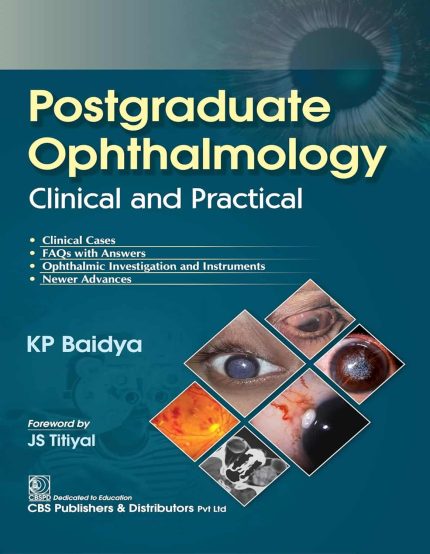 Postgraduate Ophthalmology Clinical and Practical