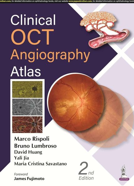 Clinical OCT Angiography Atlas