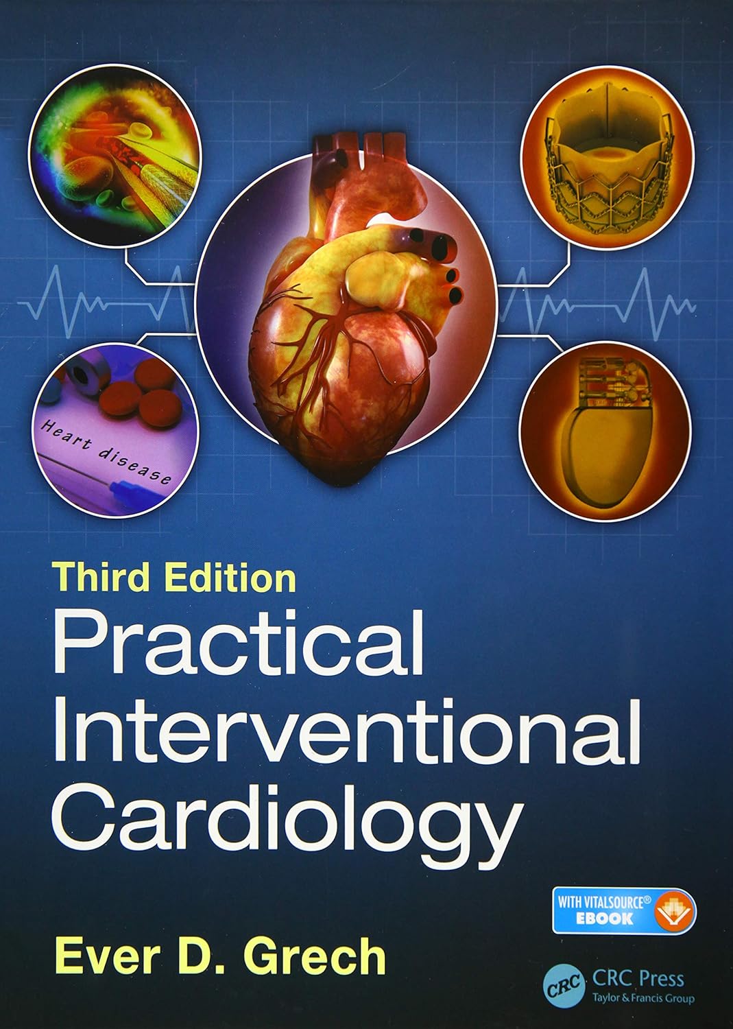 Practical Interventional Cardiology 3rd Edition
