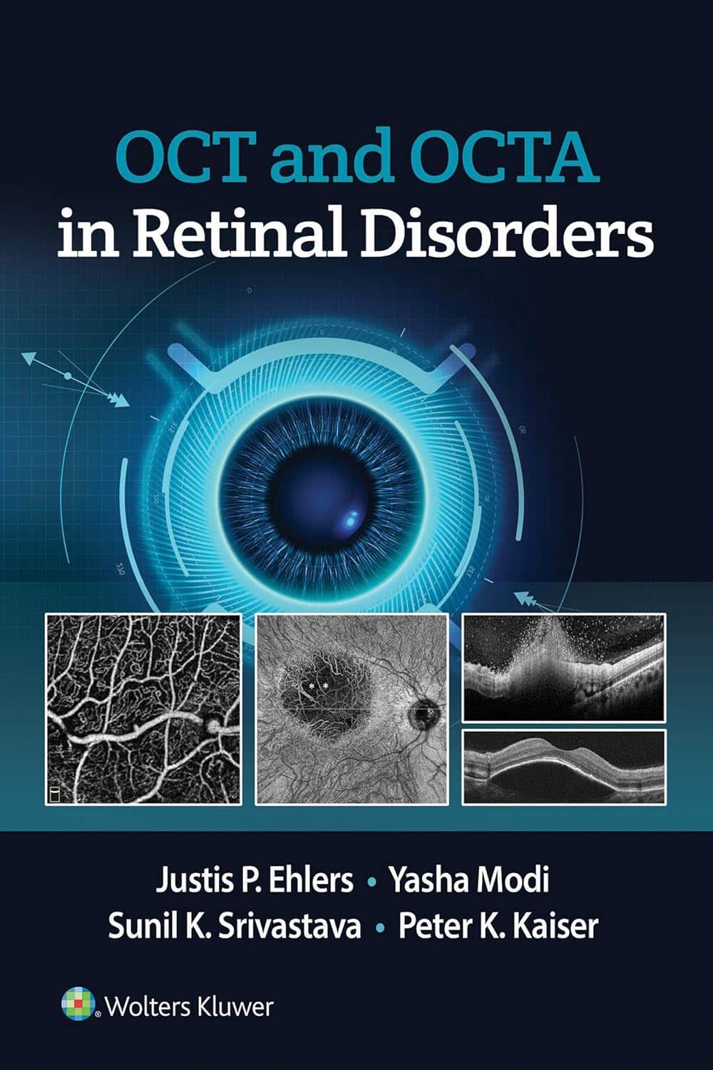 OCT and OCT Angiography in Retinal Disorders