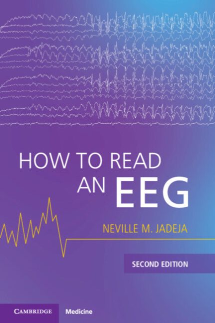 How to Read an EEG 2nd Edition