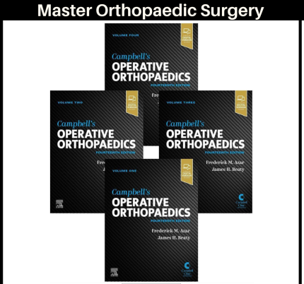 Campbell's Operative Orthopaedics, 4-Volume Set 14th Edition