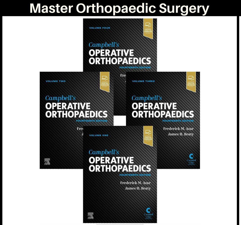 Campbell's Operative Orthopaedics, 4-Volume Set 14th Edition