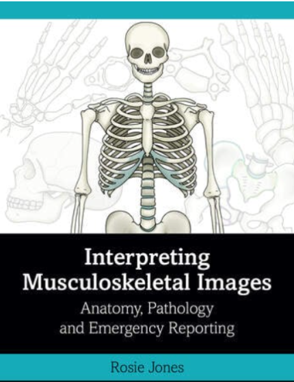 Interpreting Musculoskeletal Images: Anatomy, Pathology and Emergency Reporting