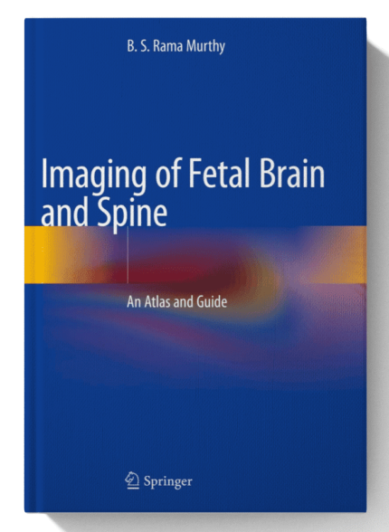 Imaging of Fetal Brain and Spine : An Atlas and Guide