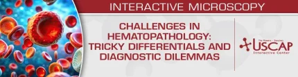 USCAP Challenges in Hematopathology: Tricky Differentials and Diagnostic Dilemmas (Videos + PDFs)