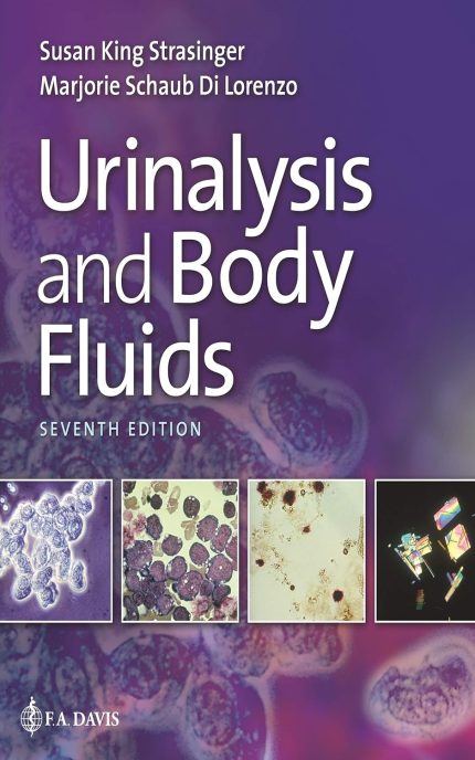 Urinalysis and Body Fluids