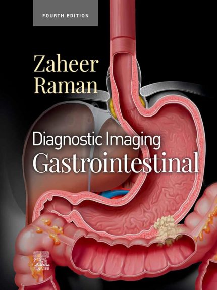 Diagnostic Imaging: Gastrointestinal - E-Book