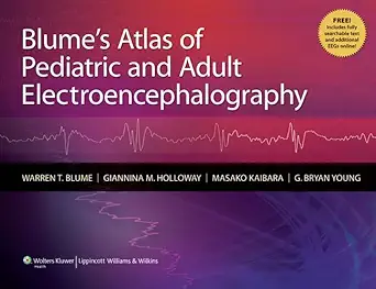 Blume's Atlas of Pediatric and Adult Electroencephalography