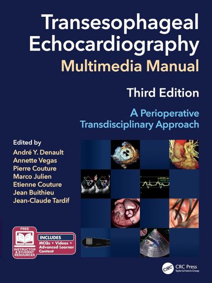 Transesophageal Echocardiography Multimedia Manual: A Perioperative Transdisciplinary Approach